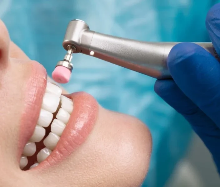 دندانپزشکی زیبایی؛ راهی مطمئن برای داشتن لبخندی جذاب